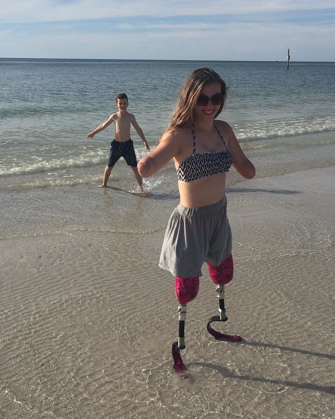 Какого жить без руки. Девушки инвалиды без ног и рук. Девочка инвалид без ноги.